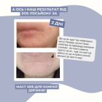 Точковий засіб core focus local sos lotion